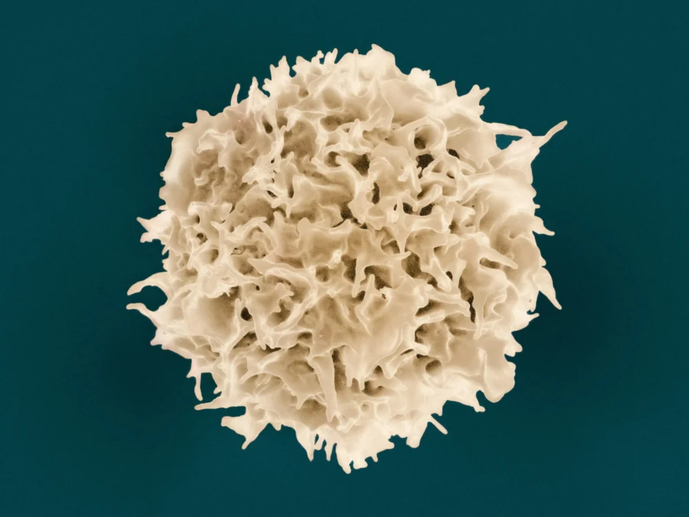 white blood cell; immune system: Photo by National Institute of Allergy and Infectious Diseases on Unsplash