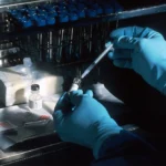 Scientists find a clue that predicts ALS in patients