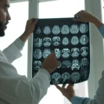 New research uncovers a potential brake on brain aging