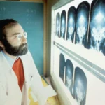 Study identifies DNA changes in Alzheimer’s brains that could reveal new treatment targets